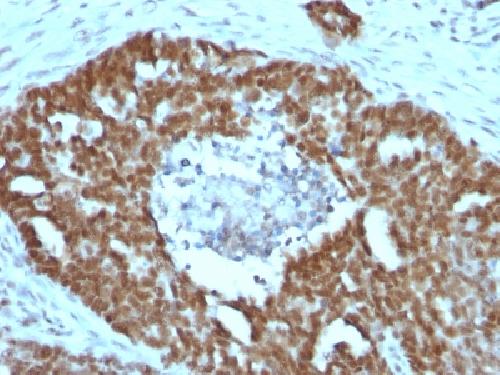 NCL Antibody