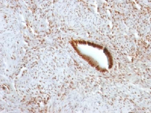 NCL Antibody