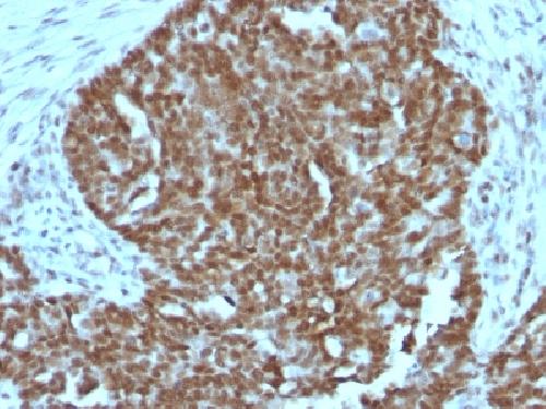NCL Antibody