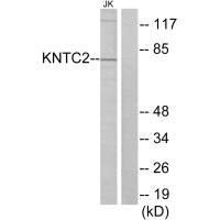 NDC80 Antibody