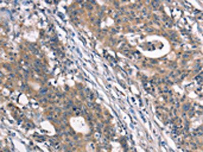 NSMCE3 Antibody