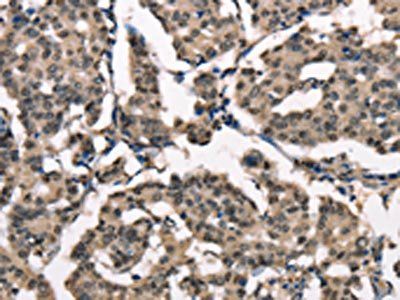 NSMCE3 Antibody