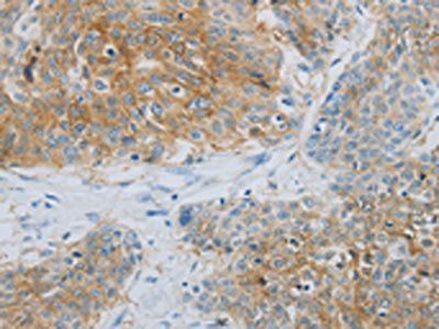 NDRG1 Antibody
