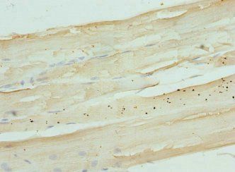NDRG2 Antibody