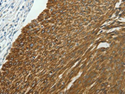 NDRG2 Antibody