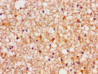 NDRG4 Antibody