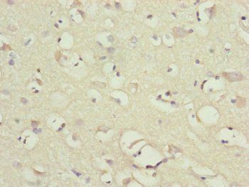 NDUFB10 Antibody