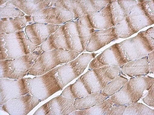 NDUFB5 Rabbit Polyclonal Antibody