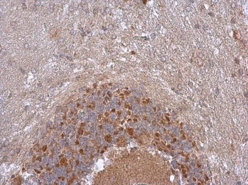 NDUFB5 Rabbit Polyclonal Antibody
