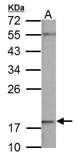 NDUFB5 Rabbit Polyclonal Antibody