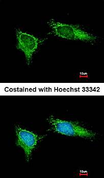 NDUFB5 Rabbit Polyclonal Antibody