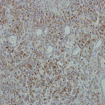 NDUFB5 Rabbit Polyclonal Antibody