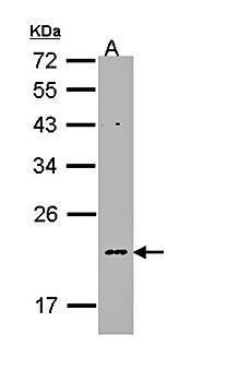 NDUFB5 Rabbit Polyclonal Antibody