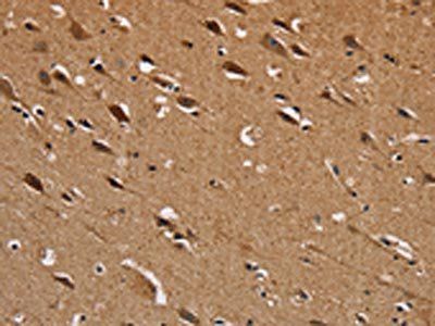 NDUFS1 Antibody