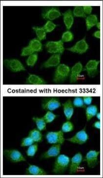 NDUFS1 Rabbit Polyclonal Antibody