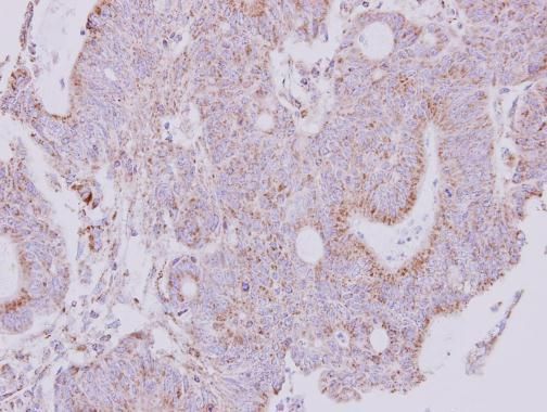 NDUFS1 Rabbit Polyclonal Antibody
