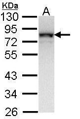 NDUFS1 Rabbit Polyclonal Antibody
