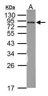 NDUFS1 Rabbit Polyclonal Antibody