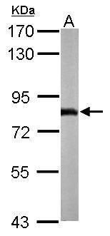 NDUFS1 Rabbit Polyclonal Antibody
