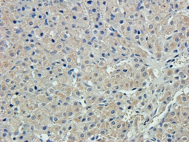 NEFH Rabbit Polyclonal Antibody