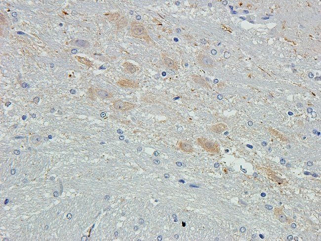 NEFH Rabbit Polyclonal Antibody