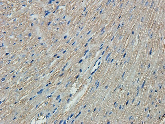 NEFH Rabbit Polyclonal Antibody