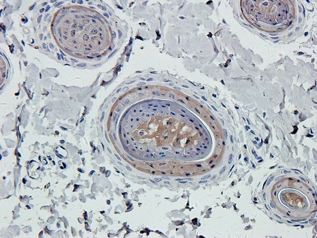 NEFH Rabbit Polyclonal Antibody
