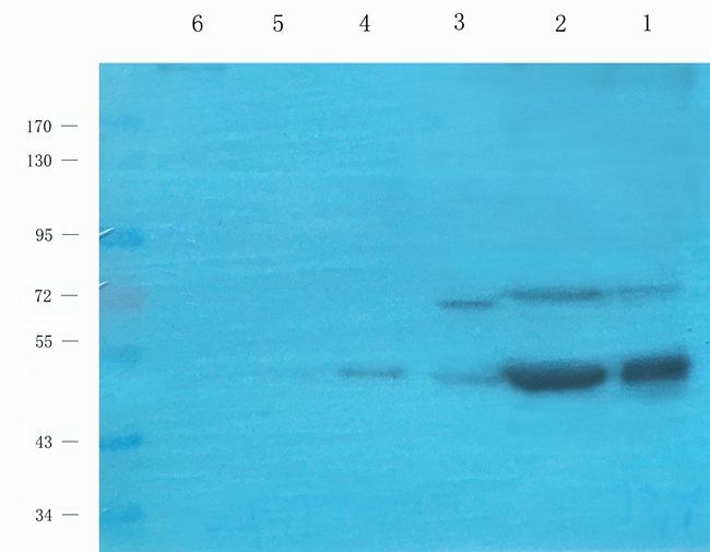 NEFH Rabbit Polyclonal Antibody