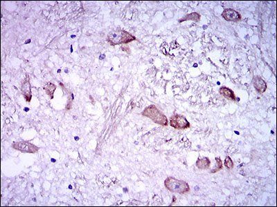 NEFH Antibody