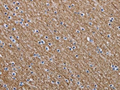 NEFM Antibody
