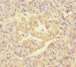 NEU1 Antibody