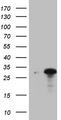 NEFM Antibody