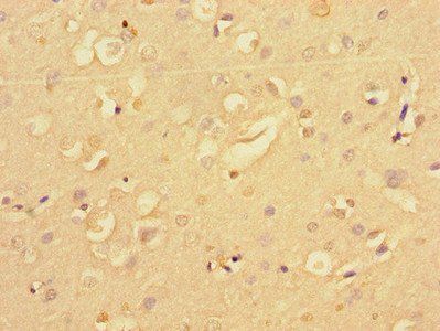 NF2 Antibody
