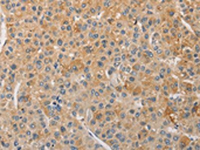 NFE2L1 Antibody