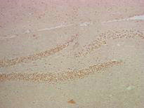 RELA Antibody
