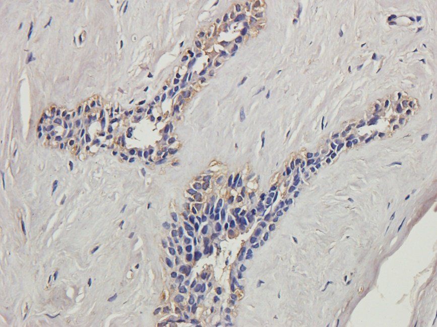 NFKB1 Rabbit Polyclonal Antibody