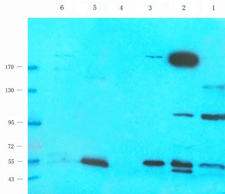 NFKB1 Rabbit Polyclonal Antibody