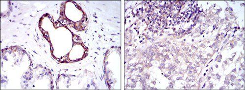 NFKB1 Antibody