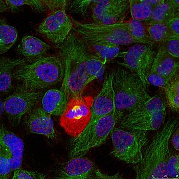 NFκB-p65 (Phospho-Thr254) Antibody