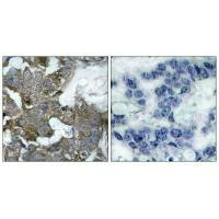 NFKBIA Antibody