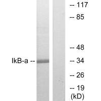 NFKBIA Antibody