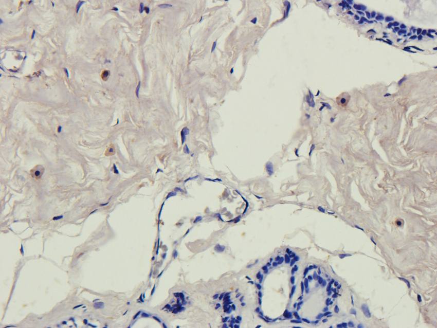 NG2 Rabbit Polyclonal Antibody