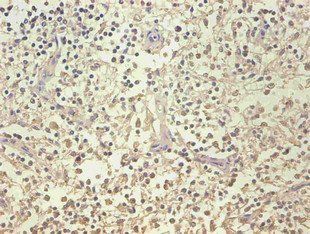 LCN2 Antibody