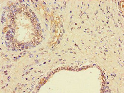 NGF Antibody