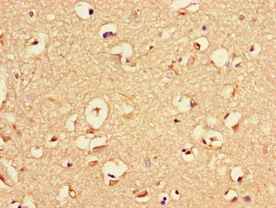 NGF Antibody
