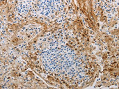 NGFR Antibody