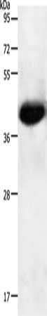 NGFR Antibody