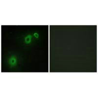 NGFR Antibody