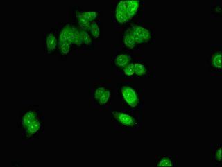 NHP2 Antibody
