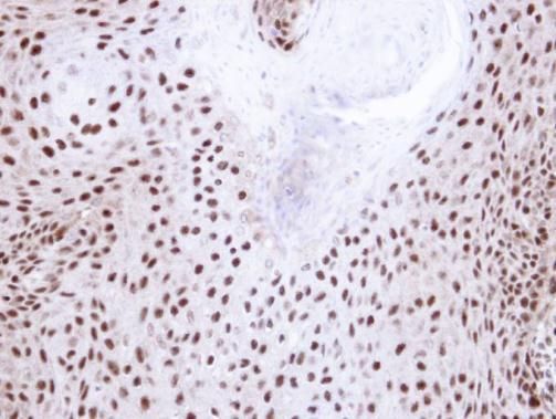 NHP2L1 Rabbit Polyclonal Antibody